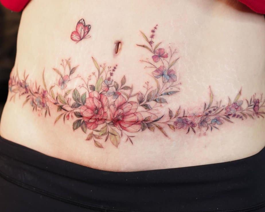 3. A colorful tummy tuck tattoo with flowers and butterflies
